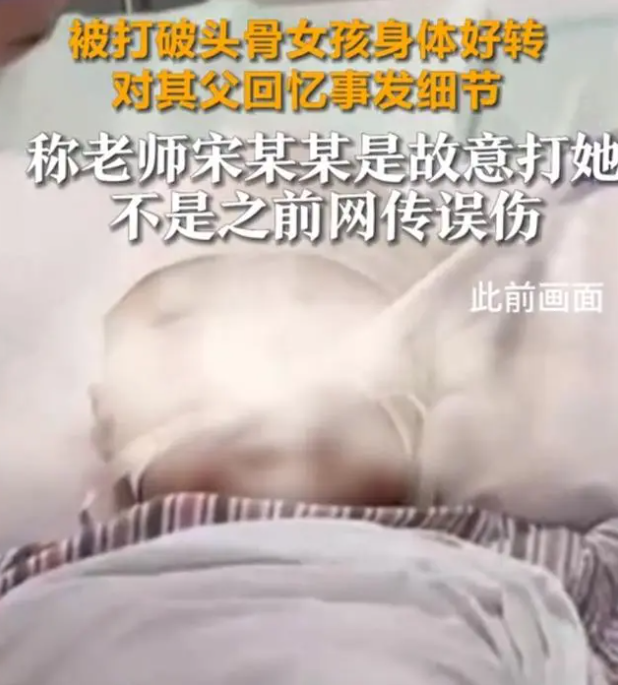 被打破頭骨女孩:老師故意打我,經(jīng)常做噩夢!