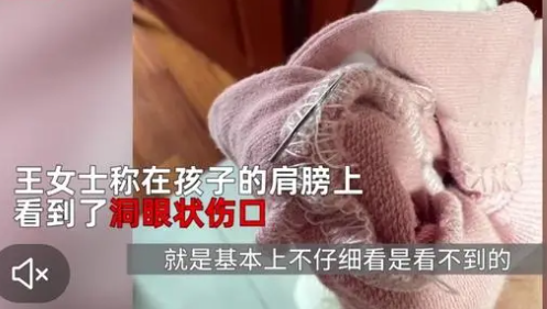 新衣藏針頭扎傷寶寶 商家：賠10元