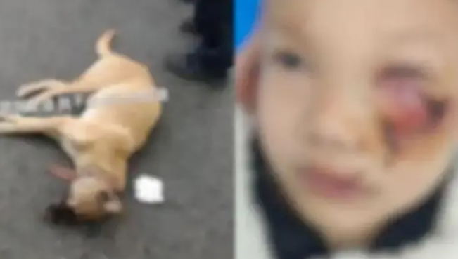 8歲男童遭狗撲咬 臉上縫了90多針！