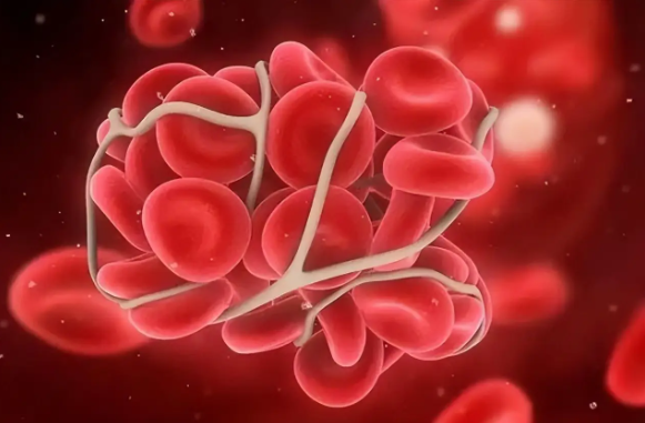 男嬰出生第2天腦梗死，父親一夜白頭