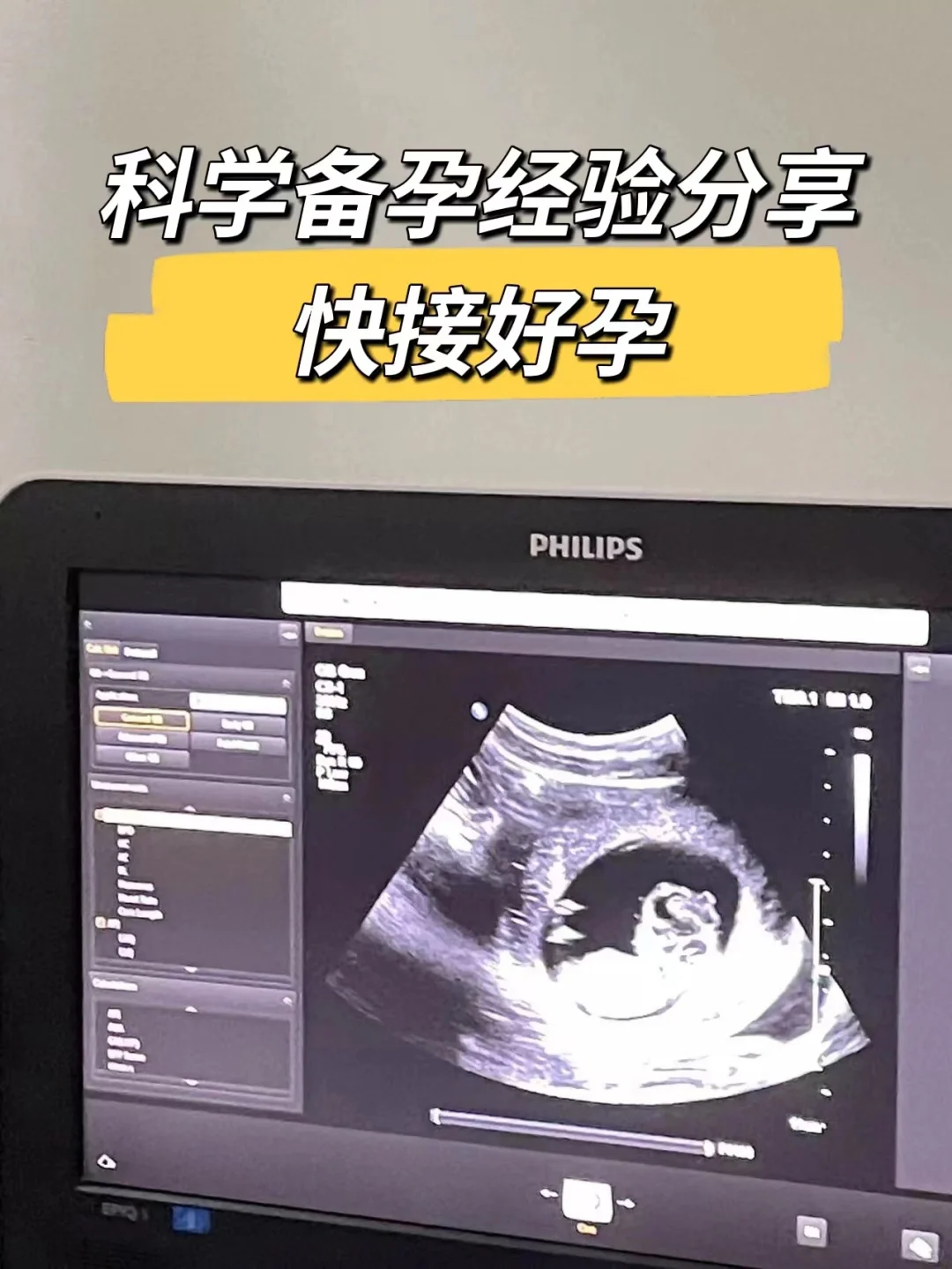 備孕葉酸【愛樂維】