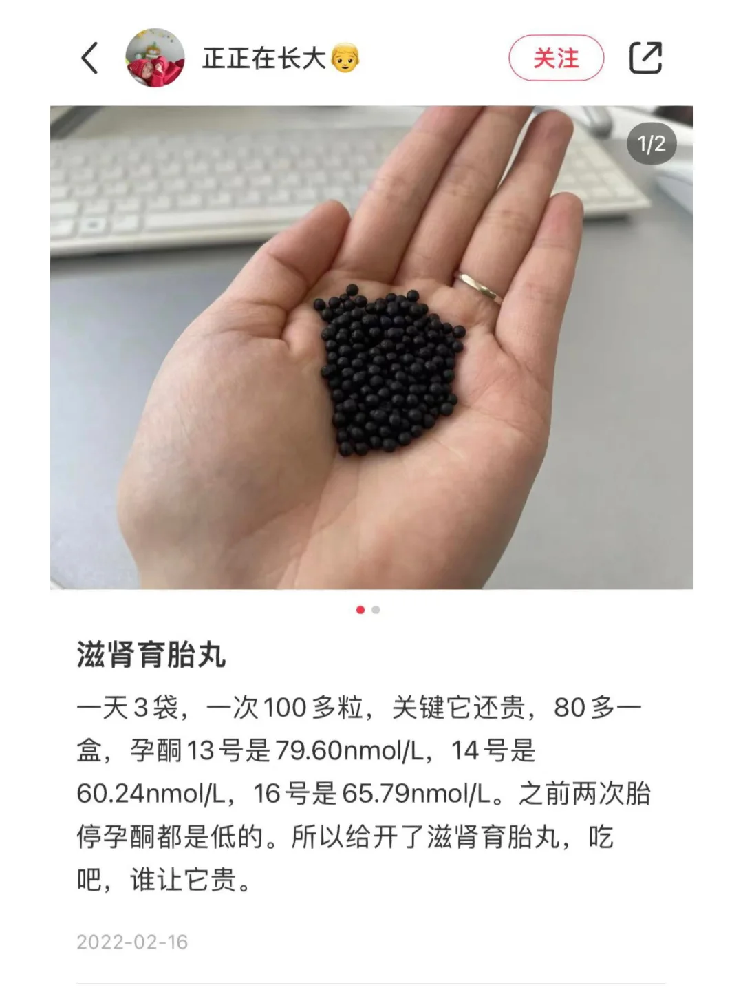 第一次產檢 一切正常