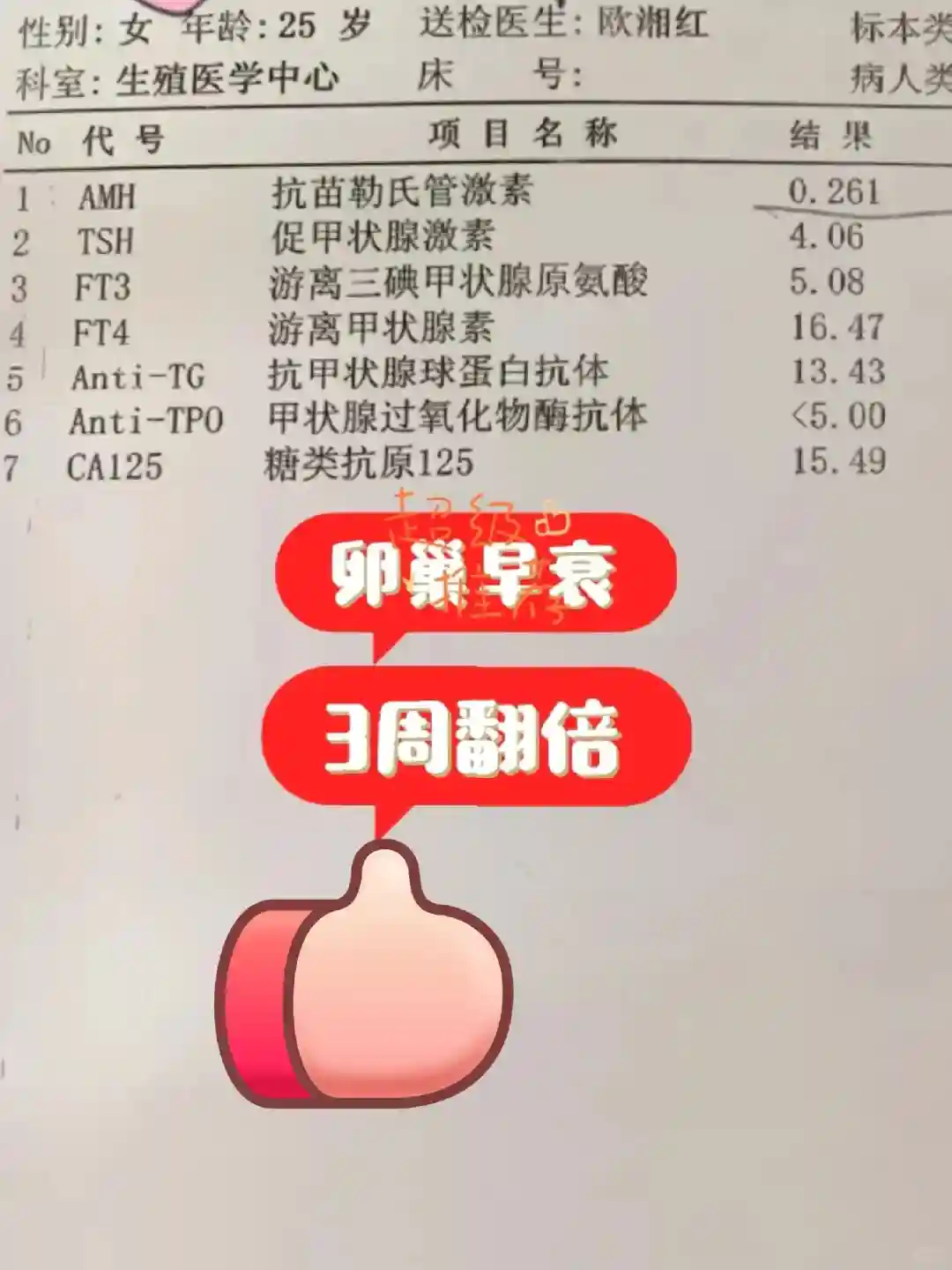 28歲，卵，巢早衰，幸好沒去做試，管