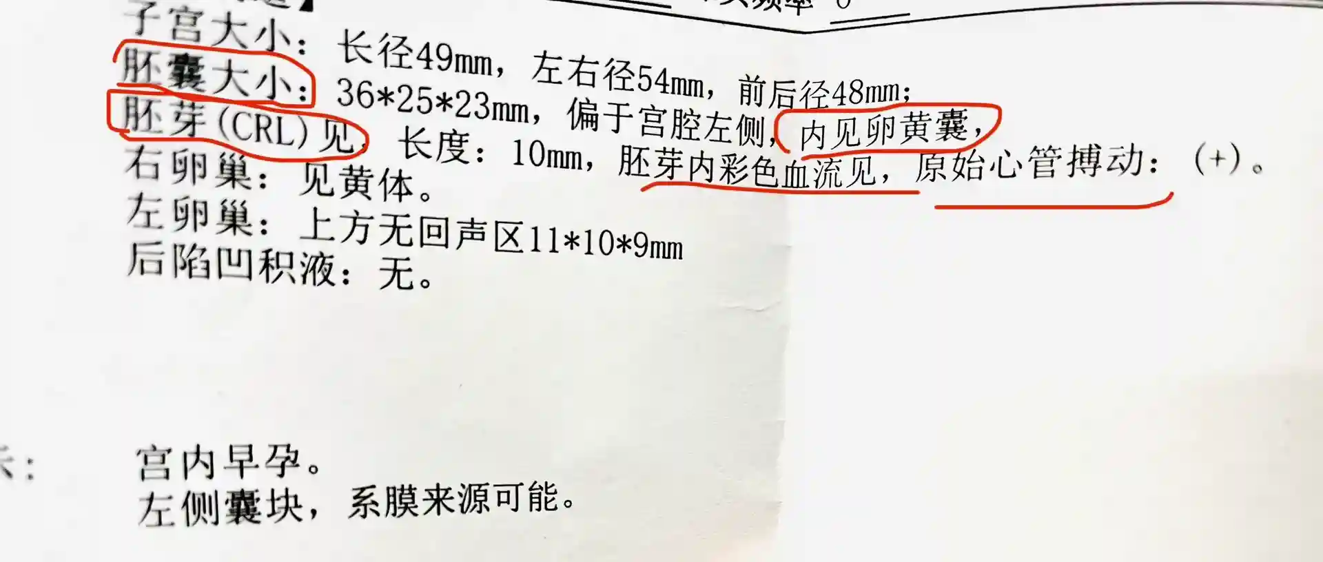 兩分鐘教你孕早期b超單怎么看