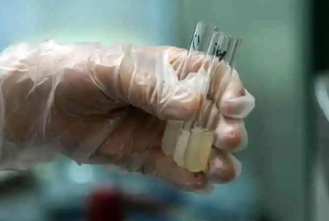 成都西囡醫院試管費用試管嬰兒有哪些花銷？