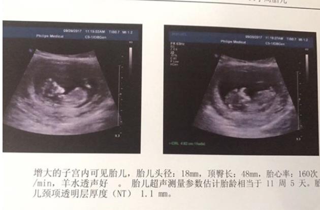 唐山供卵試管 2023
在唐山市婦幼保健院做試管嬰兒能保證選男胚女胚嗎？ ‘懷