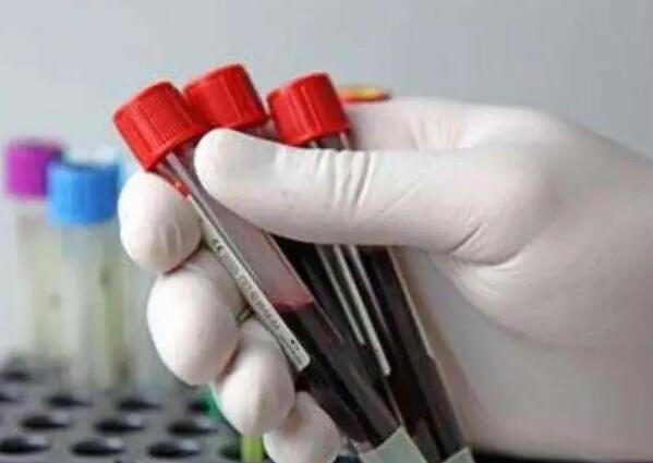 揭陽愛維艾夫醫(yī)院 揭陽愛維艾夫試管醫(yī)院怎么樣？成功率高不高？ ‘雙頂徑5.9cm股骨長4.2cm男孩女孩’