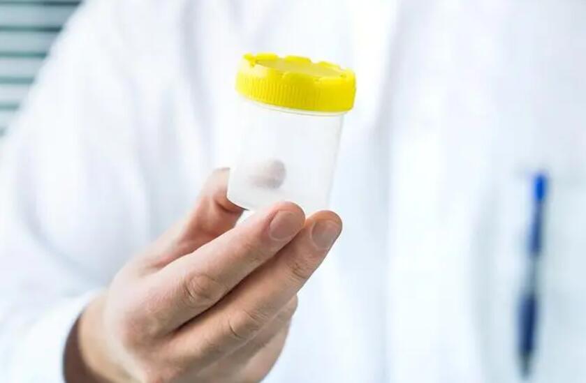 青島??電話(huà) 青島目前有哪幾家醫(yī)院能進(jìn)行供卵試管助孕技術(shù)? ‘拍四維怎樣看是男是女’