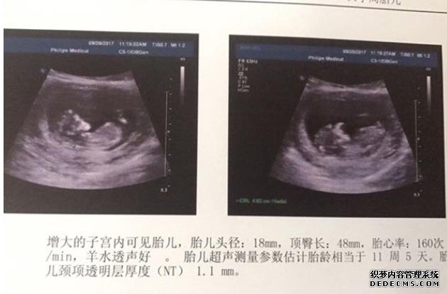 輸卵管堵塞是怎么引起的？幫你找出了6大誘因，女性值得深思！-合肥什么醫(yī)院做試管嬰兒技術(shù)好