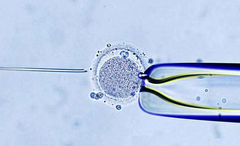 海南三代試管 海南慈銘博鰲醫(yī)院正規(guī)嗎 ‘四維下的男寶寶’