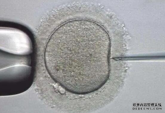 少精!弱精!死精!“爸”業難成,原來是這些原因-馬來西亞精子分離術醫院