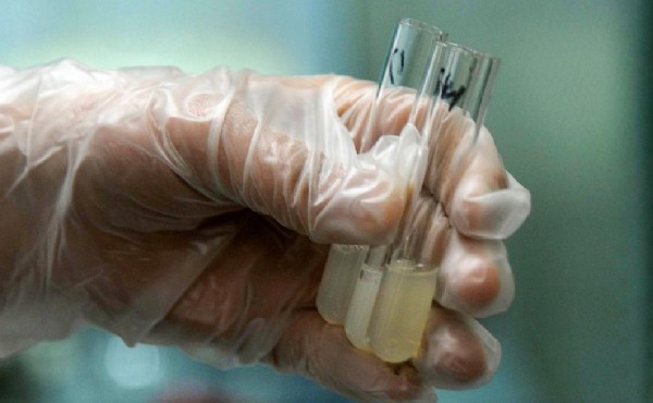 福州試管中心 福州哪家做試管嬰兒成功率高？選擇試管嬰兒醫(yī)院的標準是什么？ ‘五個月的胎兒思維彩超男女辨別’