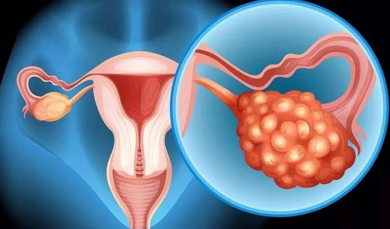 胚胎移植后怎么吃？北京試管嬰兒醫(yī)院哪家好？