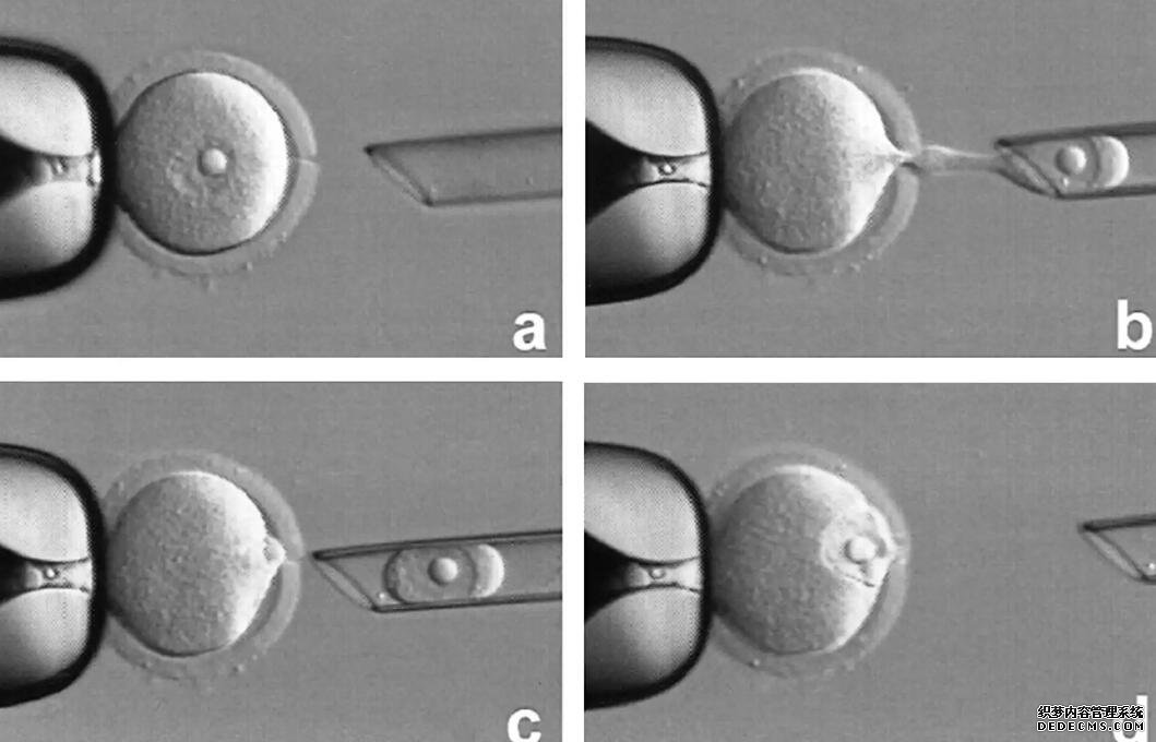 杭州供卵試管資訊 杭州不孕不育的醫(yī)生推薦。 ‘用濃度為95%的酒精測男女,怎么測最準(zhǔn)確?’