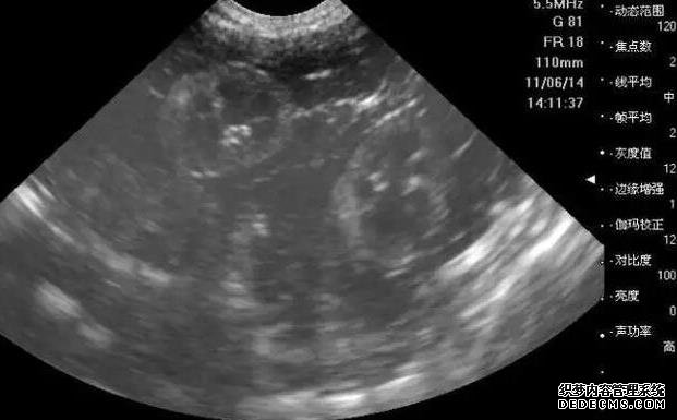 2022太原人工授精醫院排名，附成功率及費用介紹-東南大學中大醫院