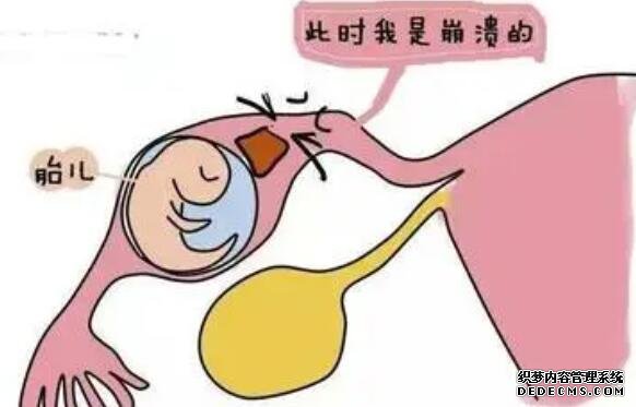 2022南京婦幼保健院試管嬰兒成功率怎么樣?-試管成功妊娠率