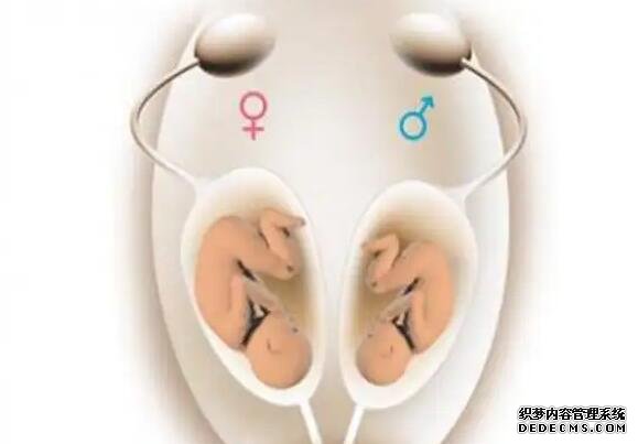 試管嬰兒技術能夠實現性別篩選,但需在特定情況下