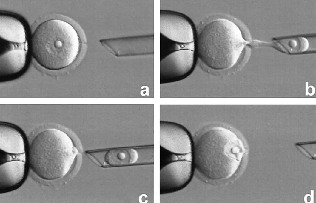 備孕期間腰酸背痛腿抽筋是怎么回事,懷孕初期會不會渾身無力還有腿酸