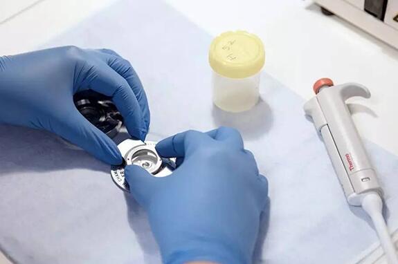 肇慶西江醫院3代試管嬰兒 肇慶西江醫院試管經歷一起來看看試管嬰兒流程 ‘頂臀徑81mm雙頂徑26mm,是男是女’