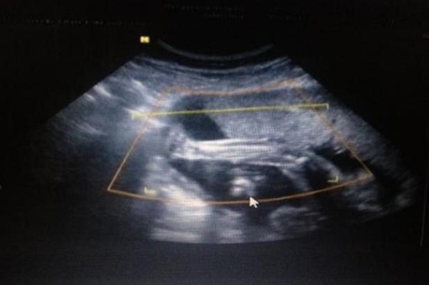 四川試管供卵 資陽哪家醫院做試管好四川資陽試管醫院 ‘懷男懷女怎么號脈’