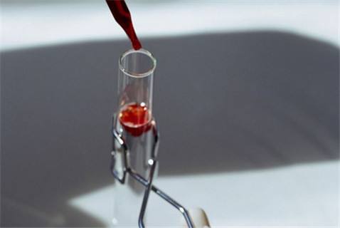 青島三代試管 2023青島少兒醫保辦理流程 ‘3個月彩超怎么看男孩女孩三個月的彩超’