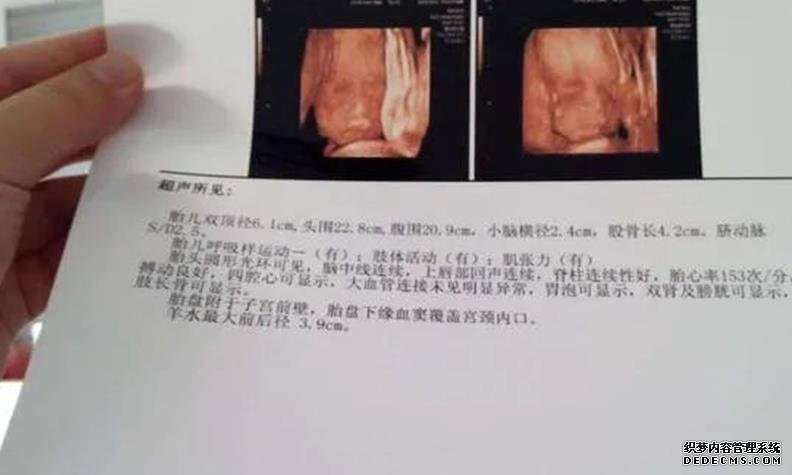 2022解放軍總醫院第一醫學中心試管嬰兒成功率一覽，附試管嬰兒成功率預估表-國內拉拉試管嬰兒機構