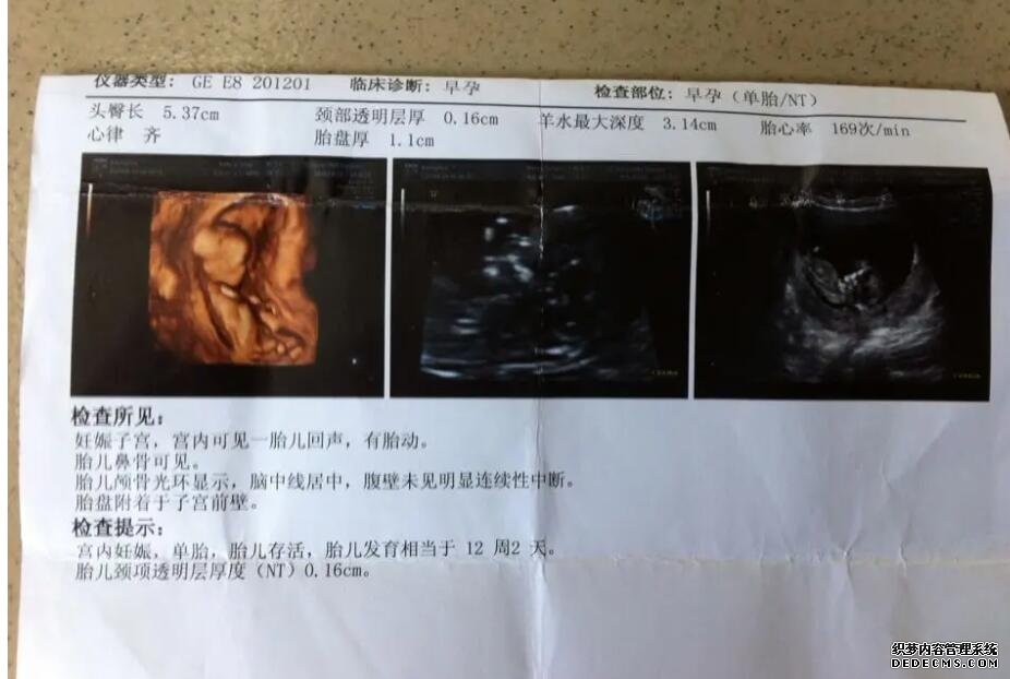 種植窗檢查有必要嗎,種植窗的檢查有幾種方法