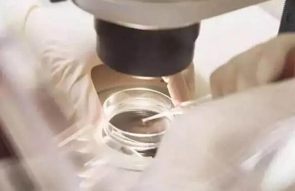 銀川生孩子最好的醫院排名 銀川市供卵試管醫院名單匯總 ‘31周b超可以看到男寶寶的睪丸嗎’