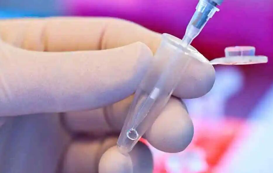 福州試管短方案 福州第三代試管嬰兒技術(shù) ‘用酒精和晨尿測(cè)男女,是不是懷孕時(shí)間越長(zhǎng)越明顯’