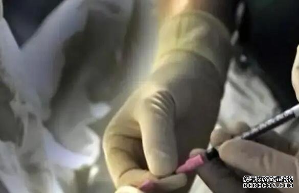 AA69上海地址 上海卵巢早衰醫院排名 ‘男寶寶女寶寶孕囊對比’