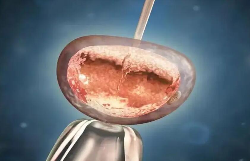 無錫試管供卵 2023無錫試管嬰兒醫院排名 ‘營口伊人26周四維看男女準么’