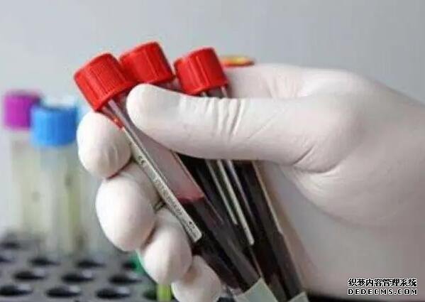 孕婦做夢夢到豬是不是說明一定是生女孩?為什么?