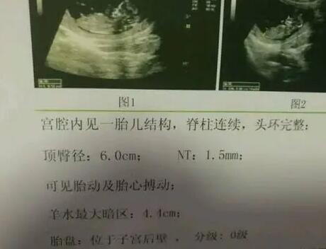 嘉興供卵試管 嘉興市婦幼保健院開展的輔助生殖技術一覽： ‘3個半月雙頂徑
