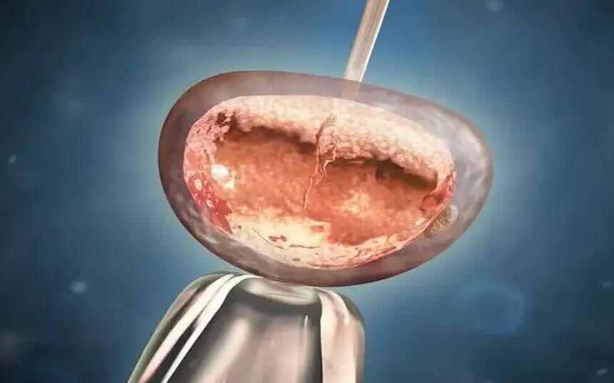 重慶試管醫院排名榜重慶試管嬰兒 重慶婦幼做試管嬰兒的費用多少? ‘24周b超可以通過長相判斷男女’