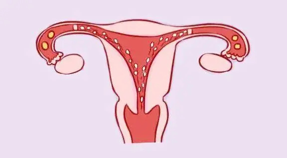 寧夏試管花費 寧夏回族自治區(qū)做供(借)卵試管嬰兒的費用 ‘雙頂徑93股骨長78是男是女呢’