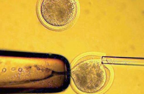 做試管嬰兒能一次要龍鳳胎嗎 