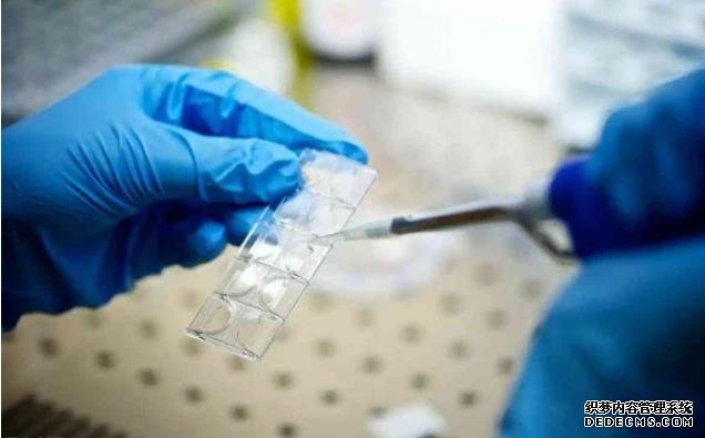 盤點女人每天泡腳的6個好處，早知早受益