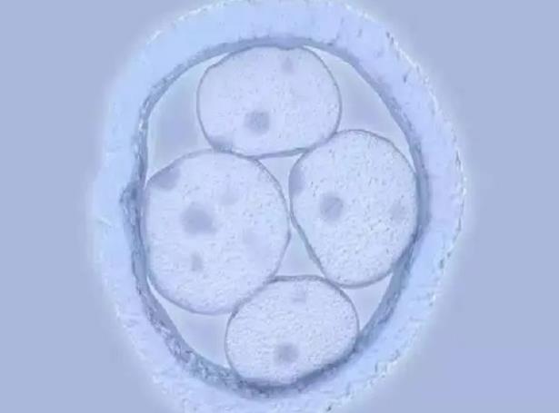 泰國試管嬰兒流程中為何需要降調(diào)在做泰國試管嬰兒過程中為什么要先降調(diào)