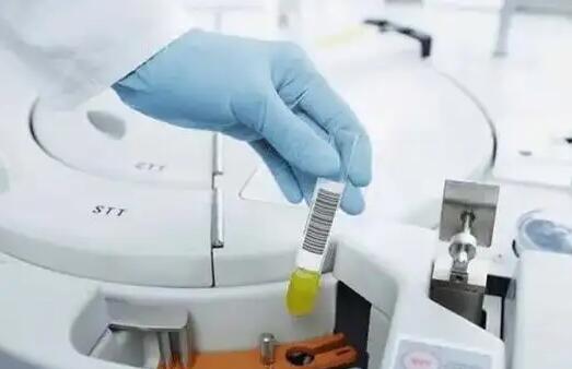 長沙試管取卵 長沙湘雅附一附二附三試管嬰兒各自擅長哪方面 ‘b超看屁股查男女準(zhǔn)嗎’