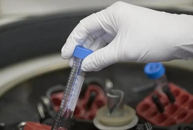 廣州哪能做供精試管 廣州中山孫逸醫院試管價錢試管嬰兒的錢花在哪？ ‘陰道三維彩超怎樣鑒別男女’