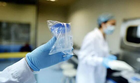 烏魯木齊最大供卵中介 烏魯木齊試管醫(yī)院哪家比較好 ‘晨尿加酒精測試男女原理’