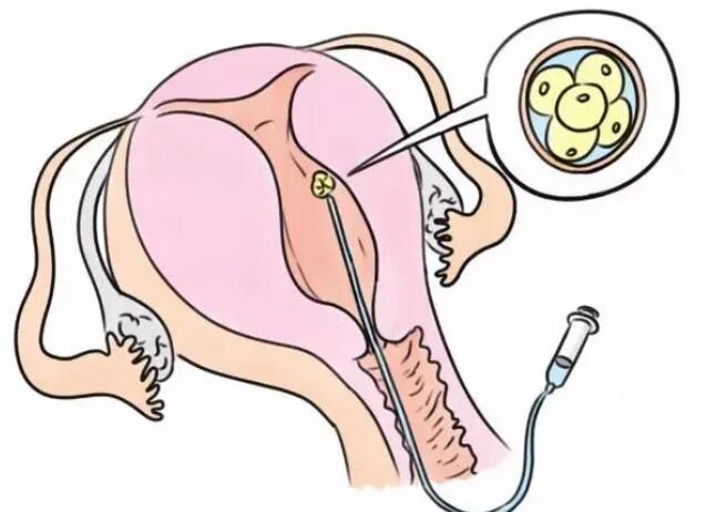 江西捐卵交流群 2022在南昌做第三代試管嬰兒選擇省一附院好還是江西婦保院好？附江西三代試管醫院排名 ‘用雙頂徑怎么看男女’