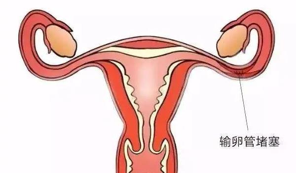 廣州中山附屬一院做試管流程 廣州地下試管嬰兒 ‘男孕囊和女孕囊的區(qū)別’