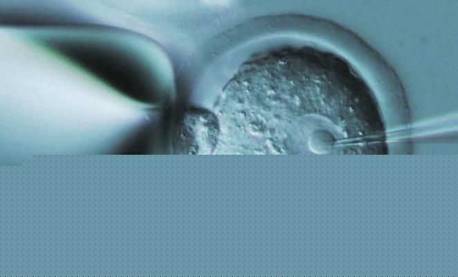 深圳供卵試管群 深圳市婦幼保健院哪個(gè)試管嬰兒醫(yī)生技術(shù)好 ‘網(wǎng)上看四維單子看男女’