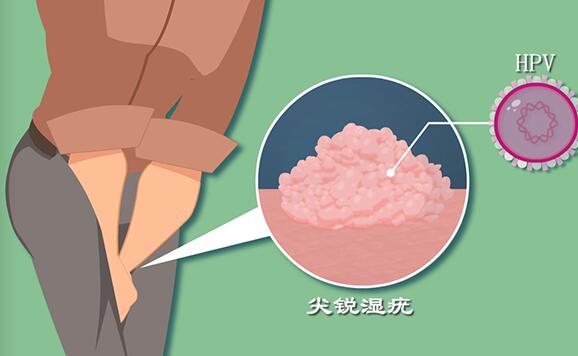 高齡備孕,試管嬰兒如何確保優(yōu)生優(yōu)育?