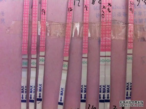 懷孕前檢查什么項目?婦科、血液、精液綜合評價