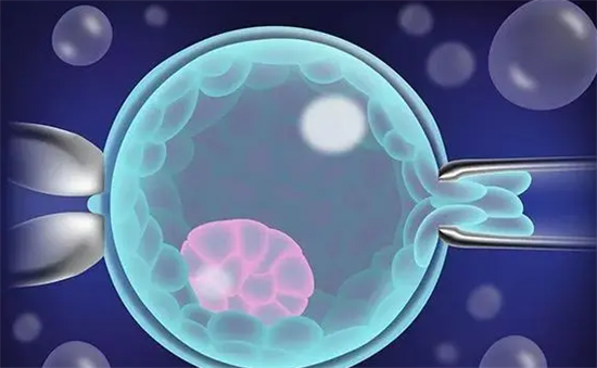 1700203388557725.png 94.png