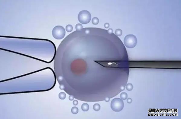 江蘇代孕后怎么上戶 江蘇省做試管嬰兒醫院排名 ‘90天彩超女寶寶圖片’