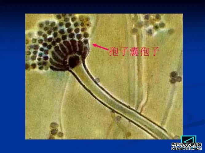 廈門供卵試管聯(lián)系方式 廈門試管嬰兒哪家醫(yī)院比較好? ‘孕囊尺寸4.7×3.7×2.4是男孩還是女孩’