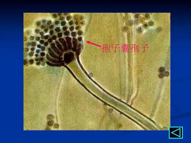 錦州試管供卵 錦州做試管怎么樣？對身體傷害更小的秘訣 ‘3個月彩超怎么看男孩女孩三個月的彩超’